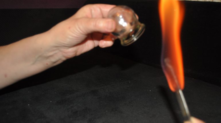 stawianie baniek ogniowych